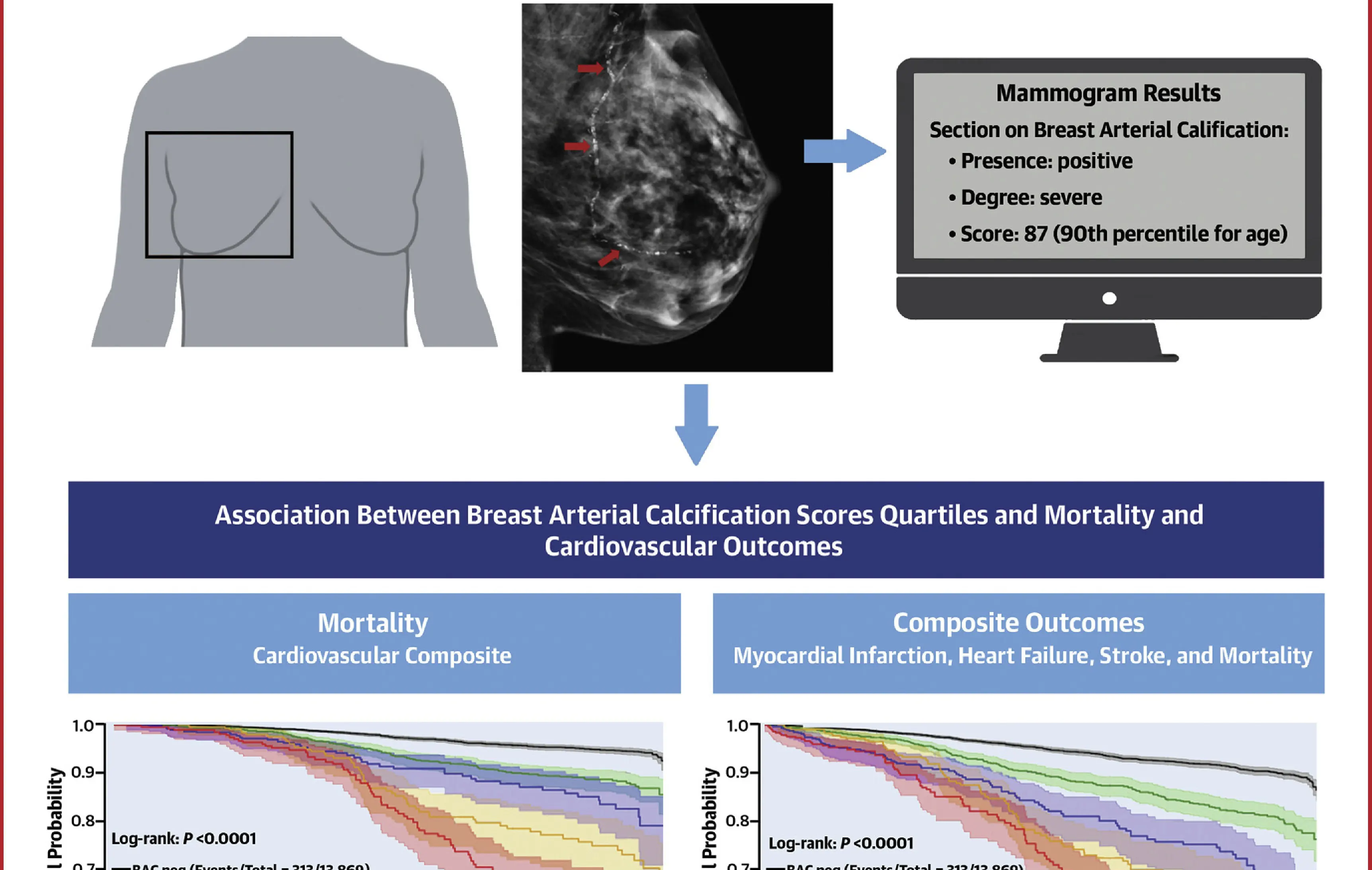 Central Illustration: Association of Automated Breast Arterial Calcification Scores With Cardiovascular Outcomes and Mortality 