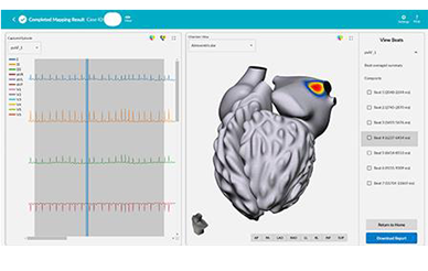 vMap is a non-invasive arrhythmia-mapping system designed to identify arrhythmia hotspots anywhere in the heart in minutes using only a 12-lead electrocardiogram