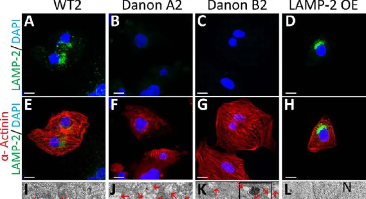 4 of 16, Figure 1 LAMP-2 deficient induced pluripotent stem…